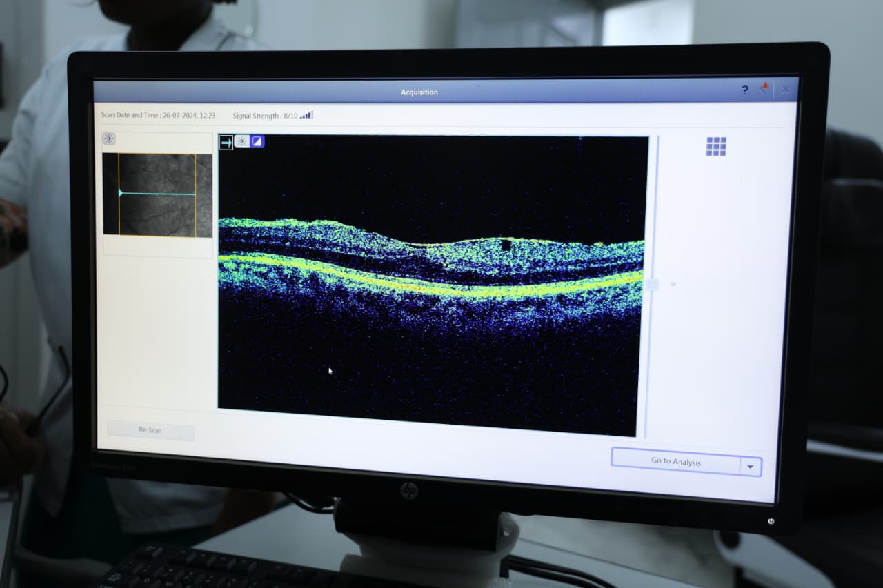 Nellai Eye Care Surgery Equipment screen